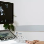 Doctor reviewing an ultrasound image on the scanner monitor