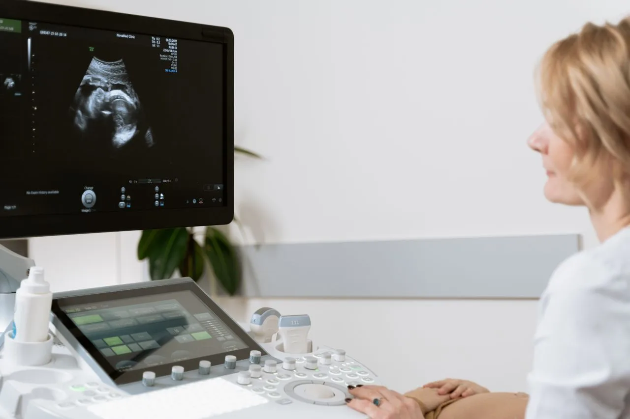 Doctor reviewing an ultrasound image on the scanner monitor