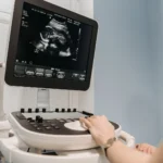 Ultrasound console and monitor showing a live scan