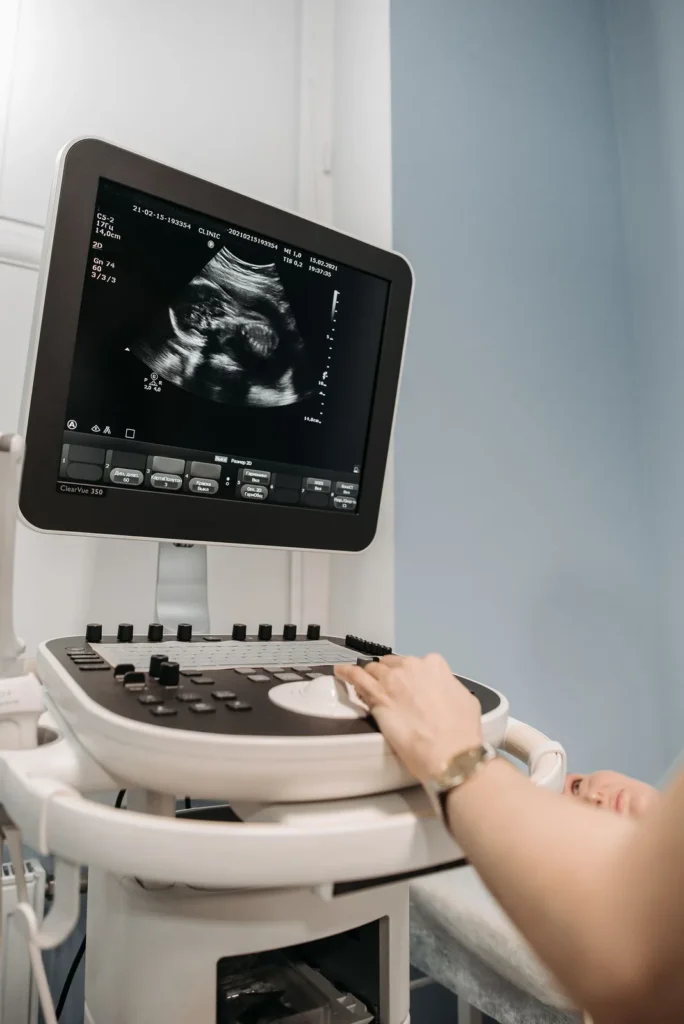 Ultrasound console and monitor showing a live scan