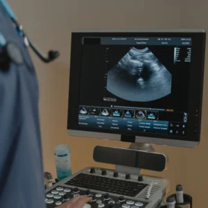Ultrasound scanner monitor and keyboard during an exam