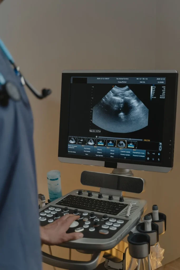 Ultrasound scanner monitor and keyboard during an exam